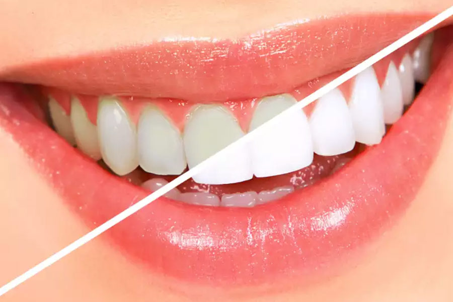 تاثیر خمیر دندان اورال بی Repair 