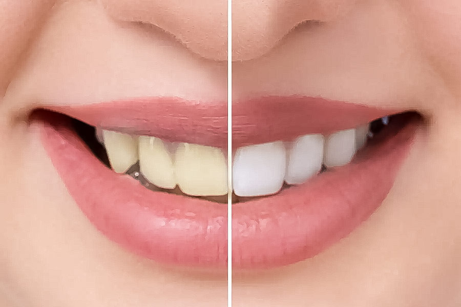 عملکرد خمیر دندان اورال بی Repair 