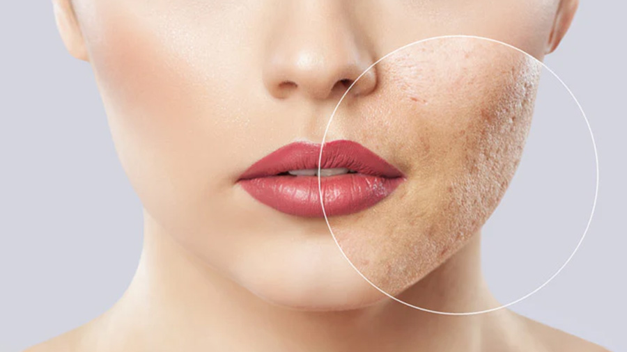 انواع لکه های پوست رو صورت و بدن چیست